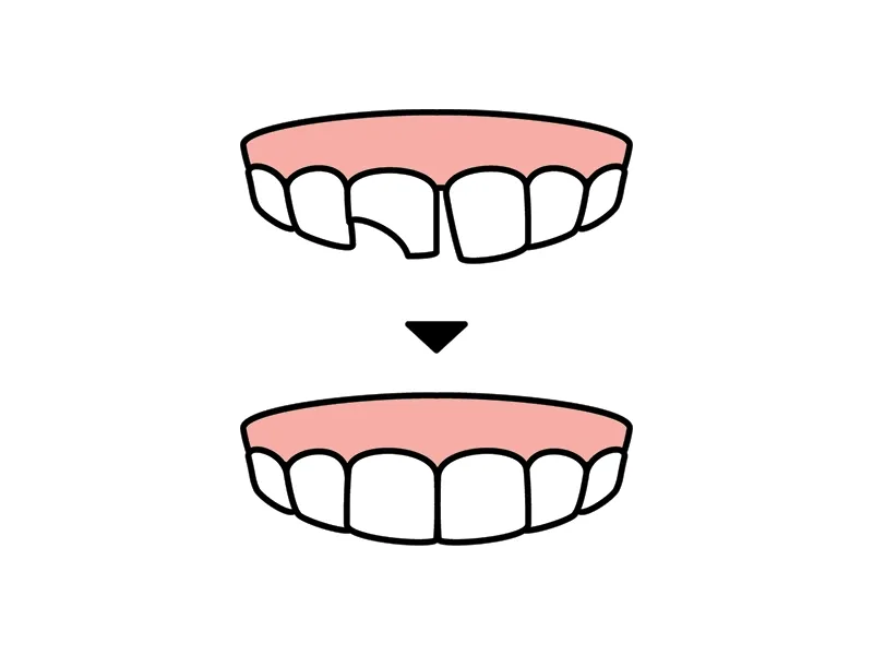 Bonding Uygulamalar Bonding Uygulamalar