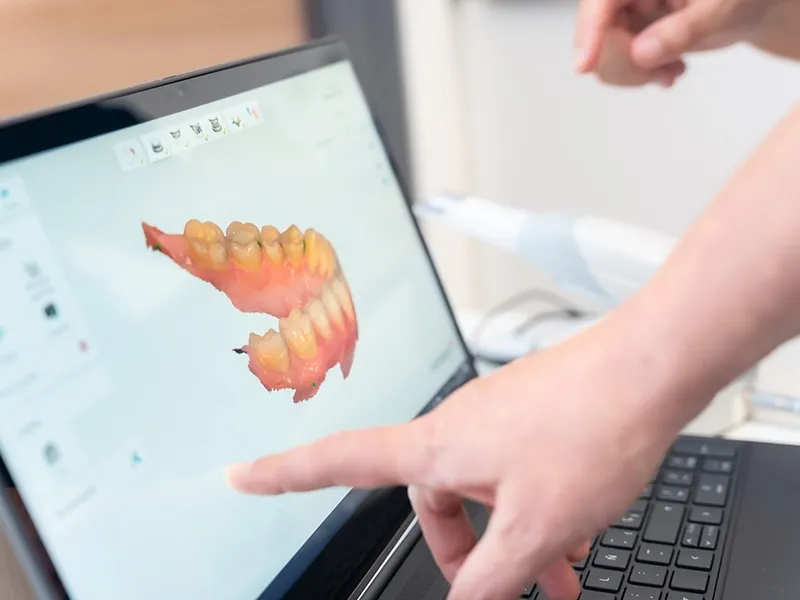 Estetik Gülüş Tasarımı Nedir? Estetik Gülüş Tasarımı Nedir?